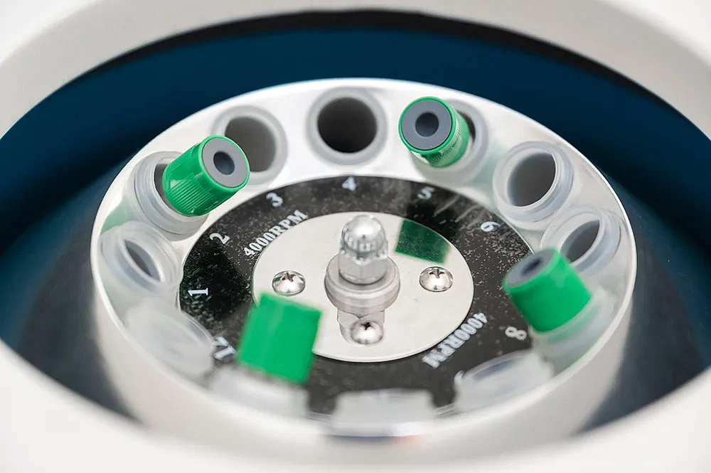 PRP терапия в клинике Rosa Springs, фото 3 - круглогодичный курорт «Роза Хутор»